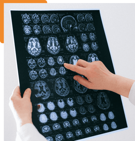Unlocking the Power of Data-Driven Healthcare for Optimal Brain Functioning